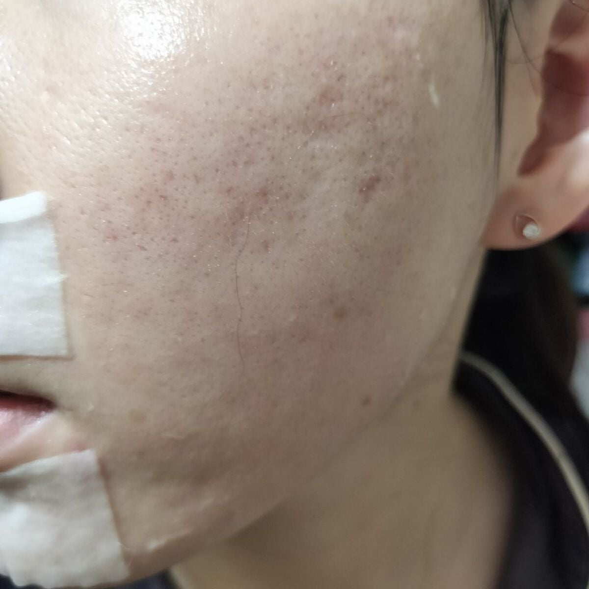 miina@汚肌工事録⚠️ on LIPS 「10/11の#汚肌工事録ありがとう!今日も頑張りましょー✨/ロ..」(2枚目)