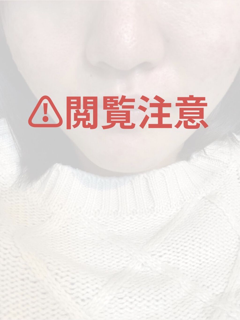 A アクネフォーム/NOV/洗顔フォームを使ったクチコミ（1枚目）