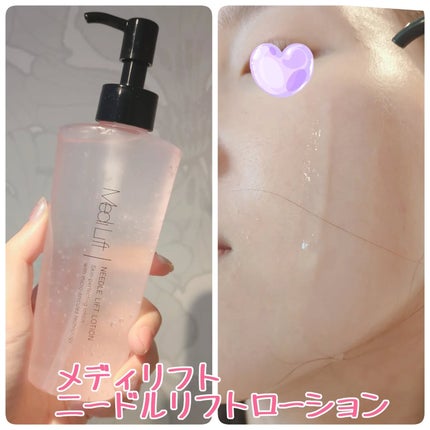 メディリフト ニードルリフトピールセラム/YA-MAN TOKYO JAPAN/美容液を使ったクチコミ(4枚目)