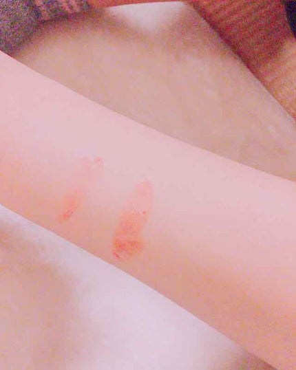 オペラ シアーリップカラー RN/OPERA/リップグロスを使ったクチコミ(2枚目)