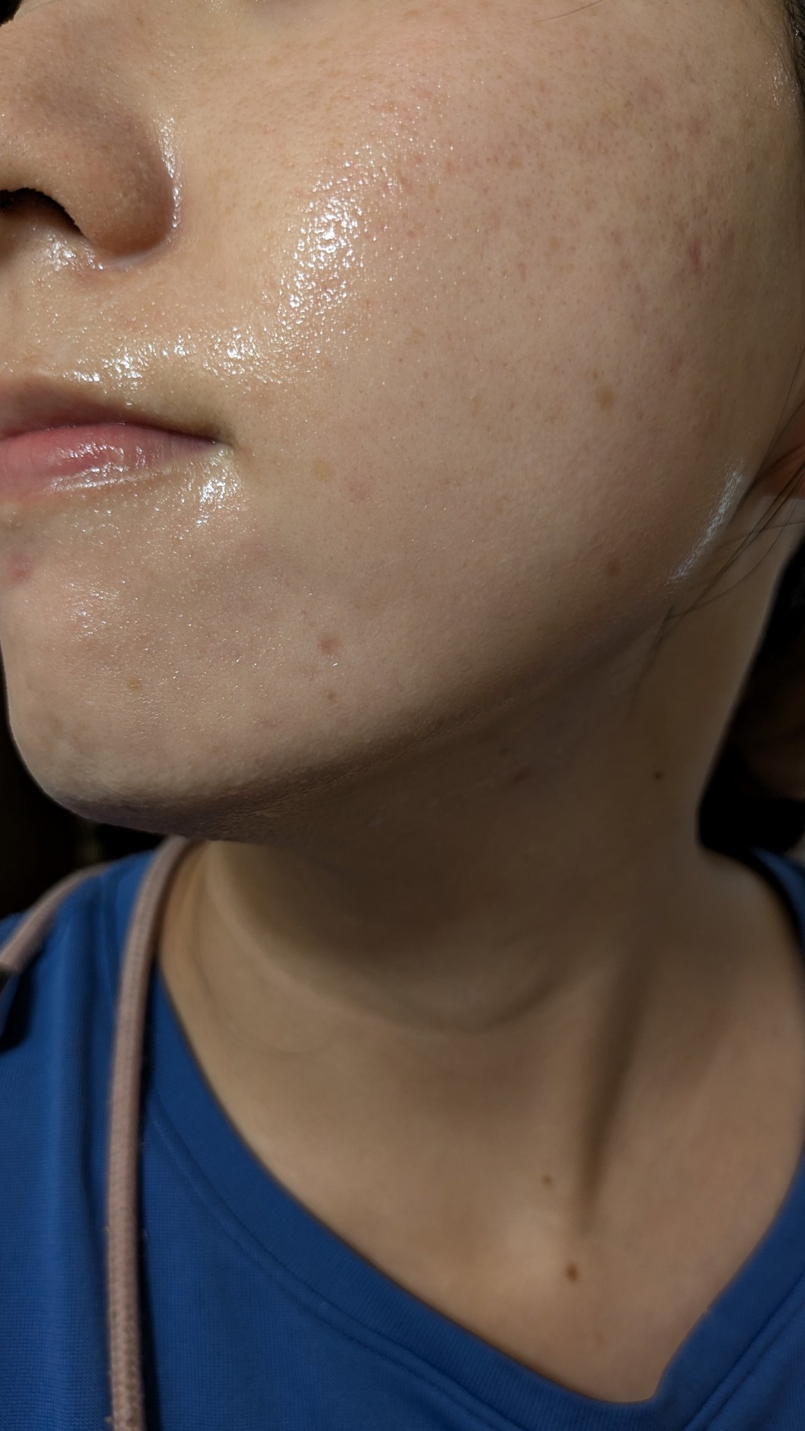 A2+NAG2ソリューション/The Ordinary/美容液を使ったクチコミ（3枚目）