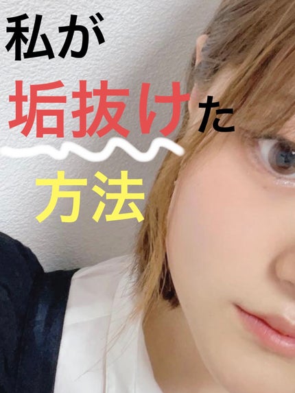 DHC ビタミンCハードカプセル/DHC/美容サプリメントを使ったクチコミ(1枚目)