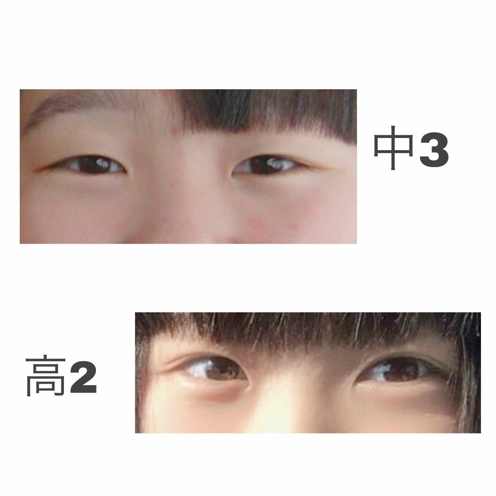 救急ばんそうこう/ドン・キホーテ/その他を使ったクチコミ(4枚目)