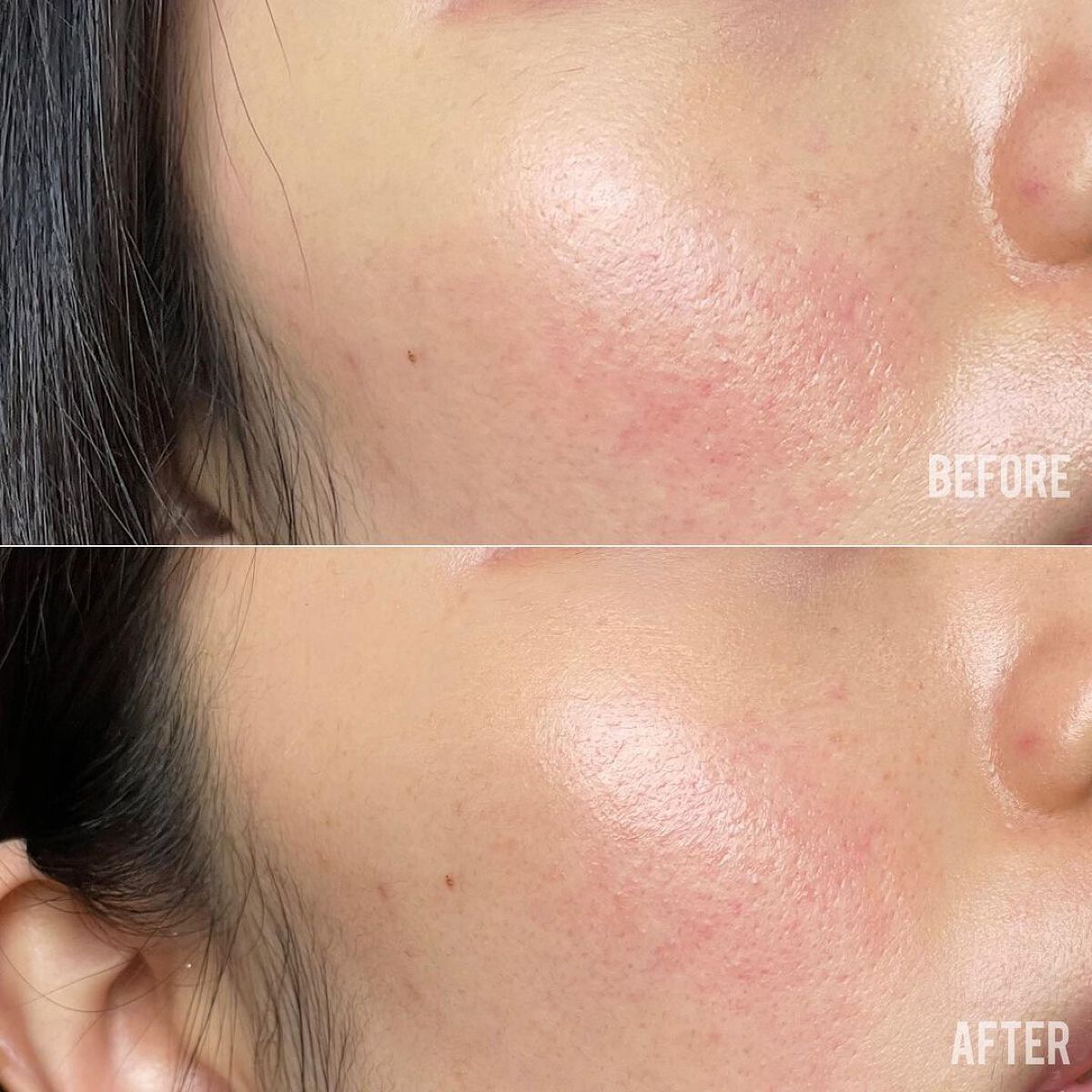 プレミアムローサモデリングマスク/Dr.Althea/マスクを使ったクチコミ(3枚目)