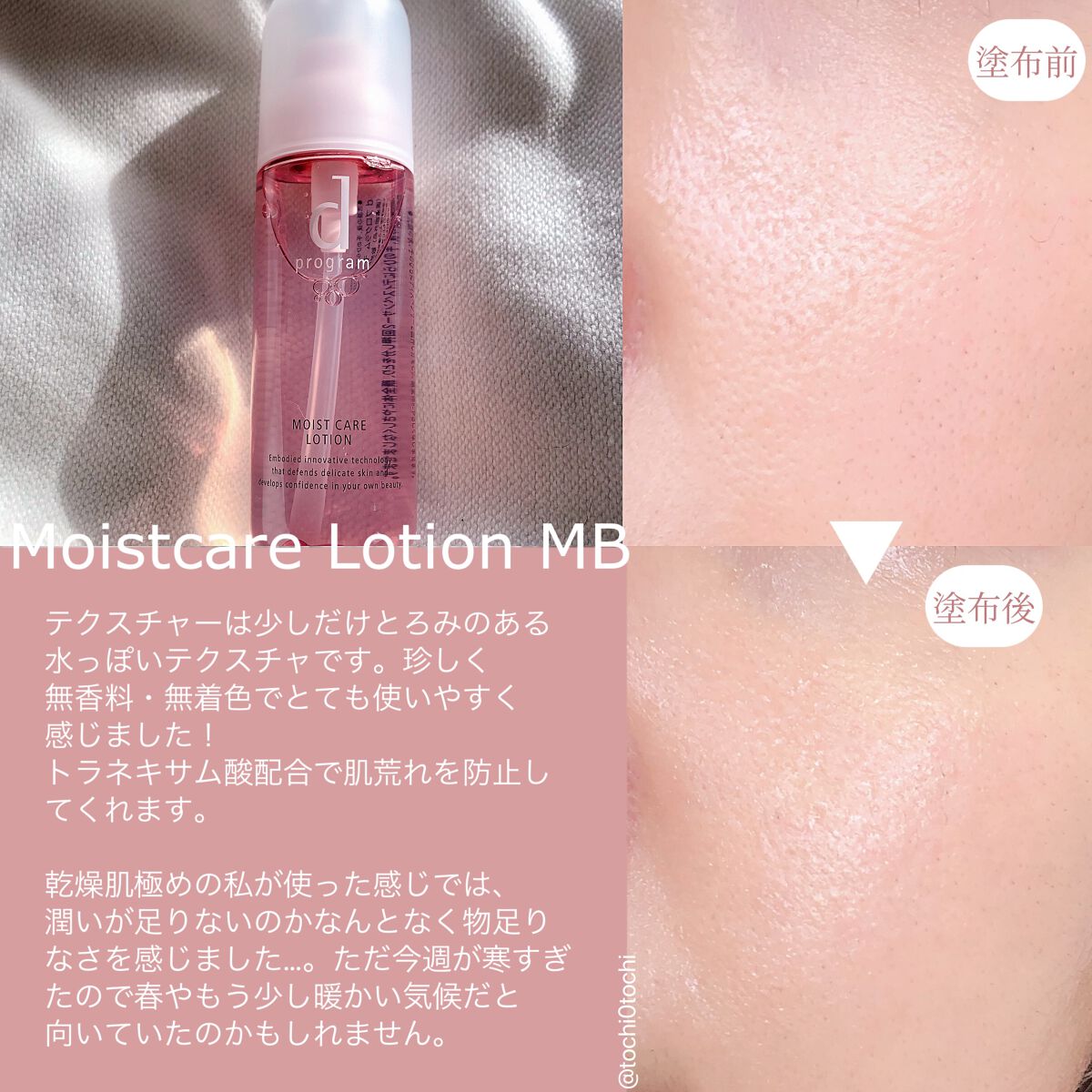 アレルバリア ミスト/d プログラム/ミスト状化粧水を使ったクチコミ（2枚目）