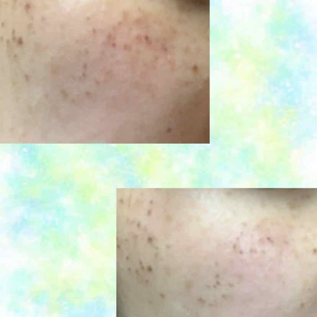 ãããªð«ãã©ãã100.% on LIPS ãäœèª¿äžè¯ã§åçããŸã°ãã«ãªã£ãŠããŸã£ããæçš¿ãé
ããããšãã¿ãŸ..ãïŒ2æç®ïŒ