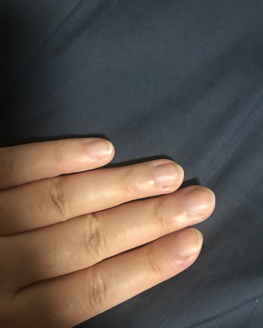 イノーチェ　ネイルティント/ナリスアップ/ネイルオイル・トリートメントを使ったクチコミ（2枚目）