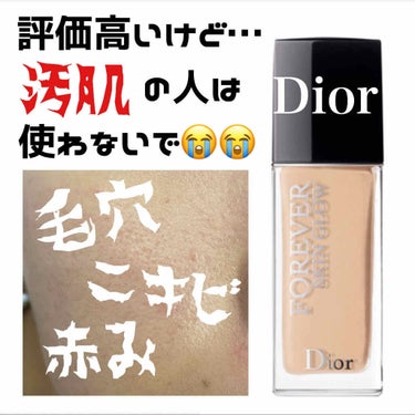 【旧】ディオールスキン フォーエヴァー フルイド グロウ/Dior/リキッドファンデーションを使ったクチコミ（1枚目）