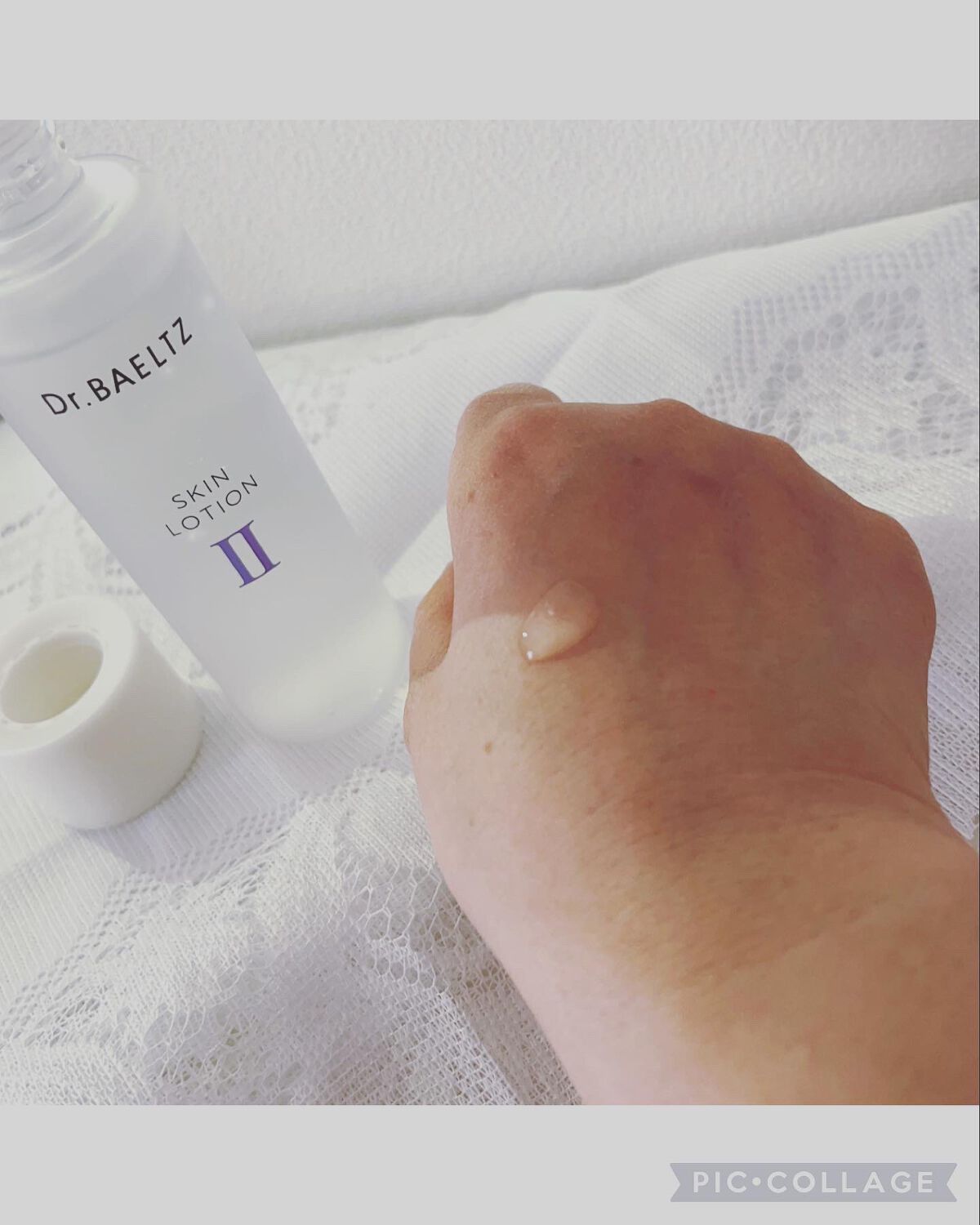 スキンローションII/ドクターベルツ/化粧水を使ったクチコミ（2枚目）