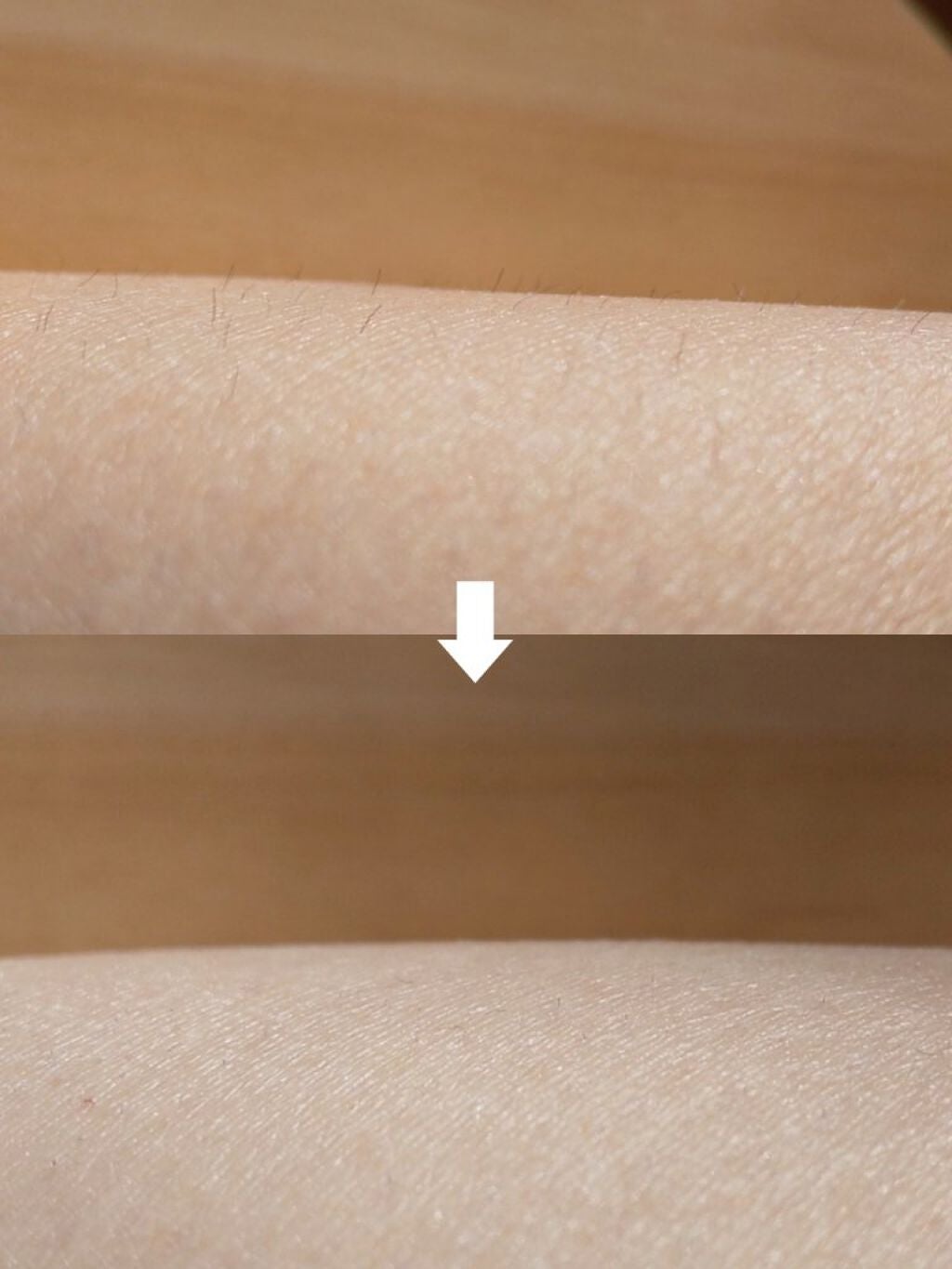 bi-hada ompa L ホルダー替刃2個付/貝印/シェーバーを使ったクチコミ(7枚目)