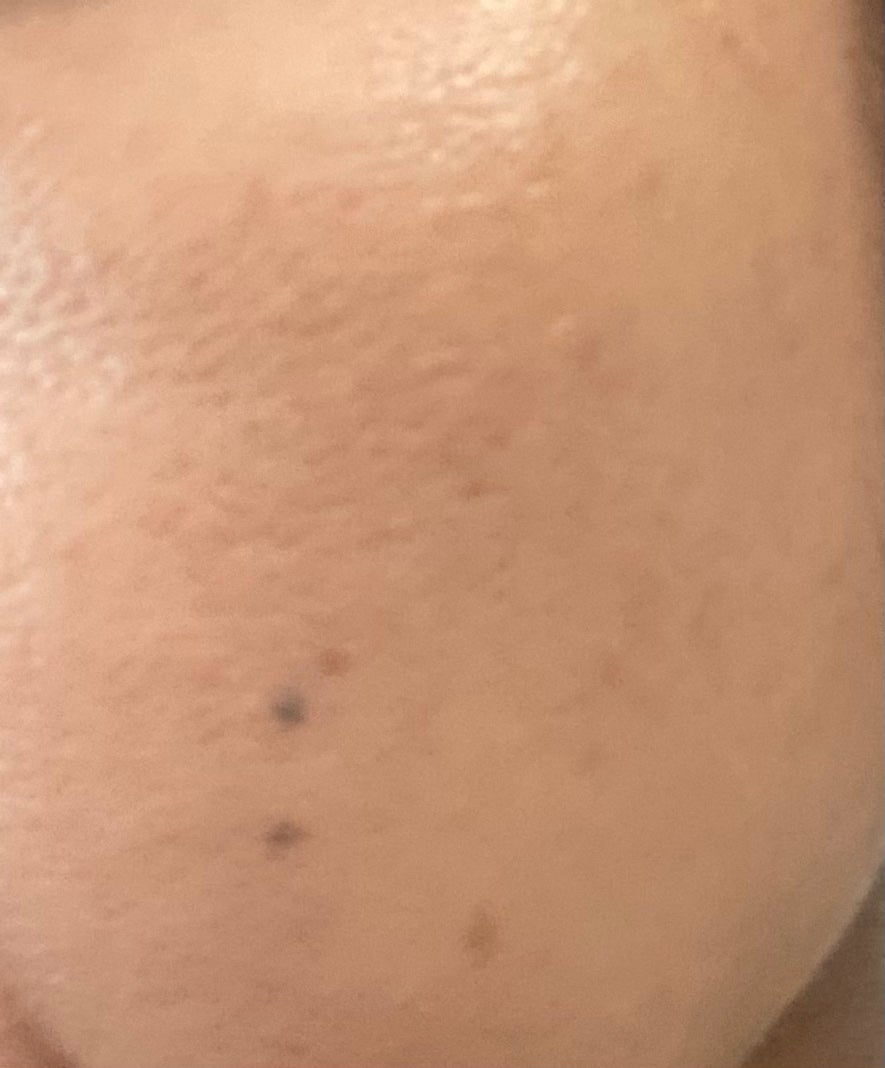 エッセンス スキングロウ ファンデーション/SHISEIDO/リキッドファンデーションを使ったクチコミ(3枚目)