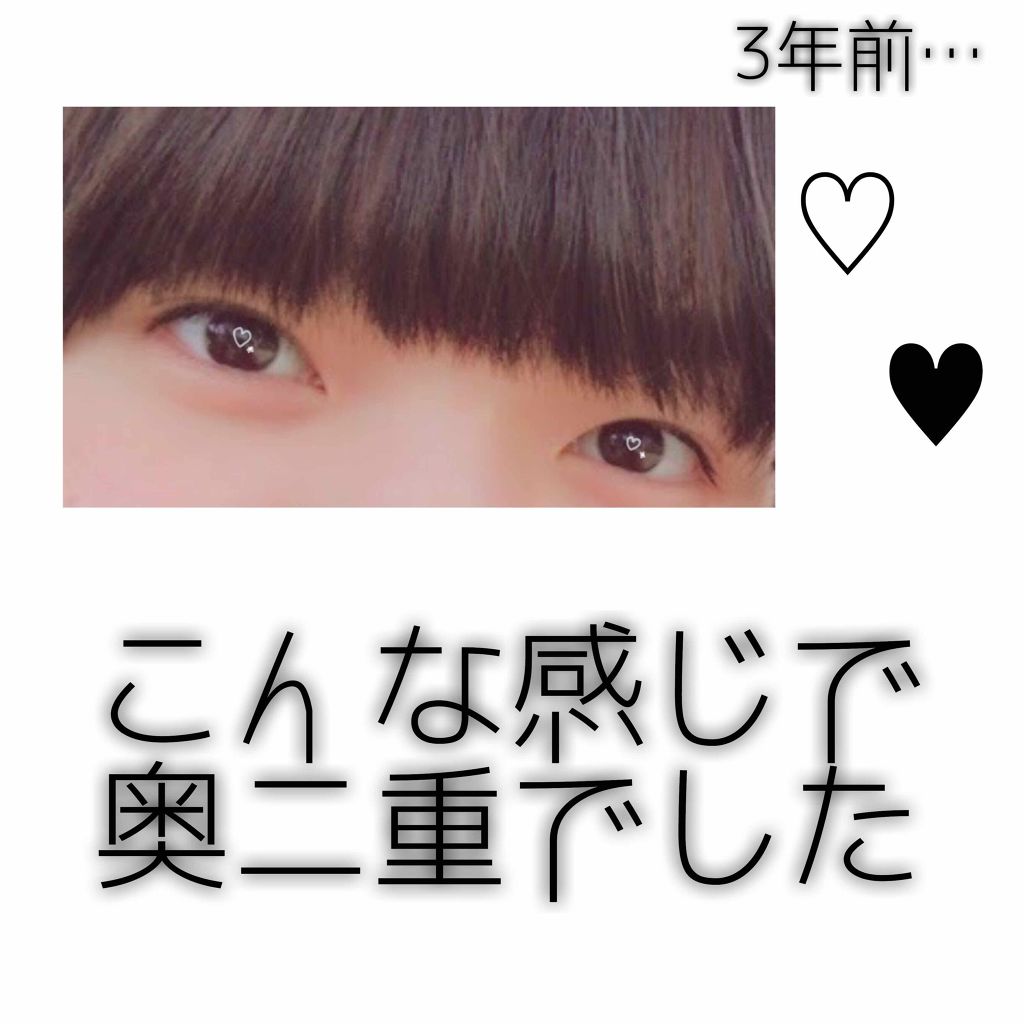 アイテープ(絆創膏タイプ、レギュラー、70枚)/DAISO/二重まぶた用アイテムを使ったクチコミ(2枚目)