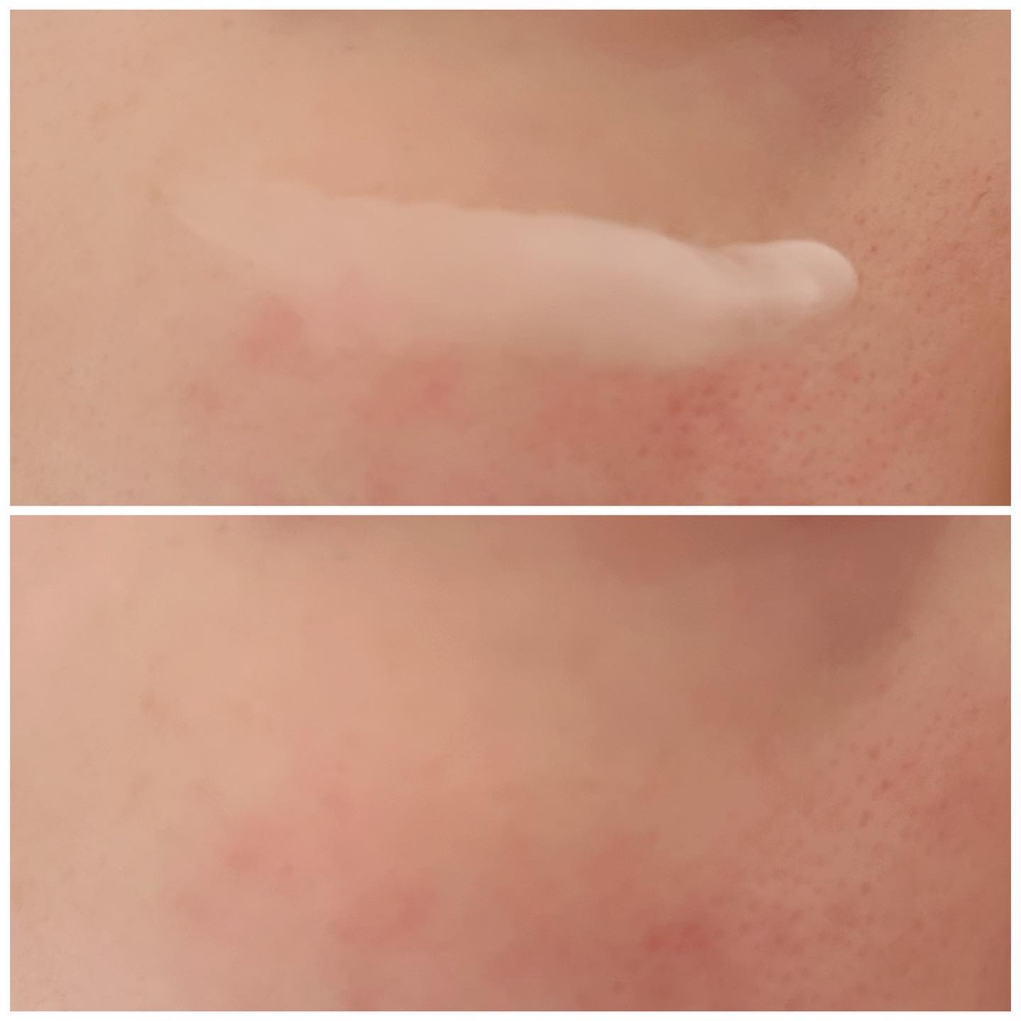 プロバイオダーム リフティング クリーム/BIOHEAL BOH/フェイスクリームを使ったクチコミ（3枚目）