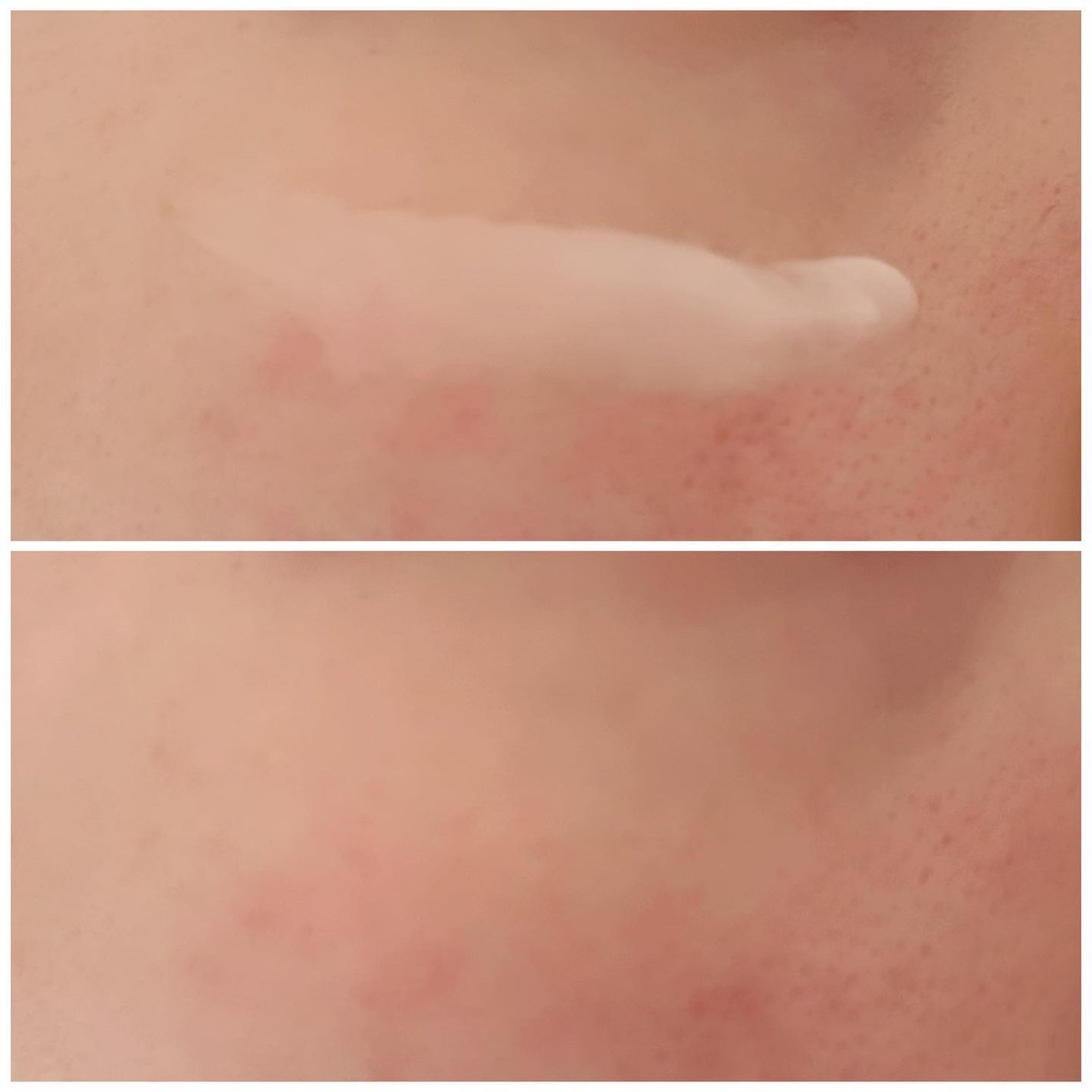 プロバイオダーム リフティング クリーム/BIOHEAL BOH/フェイスクリームを使ったクチコミ(3枚目)