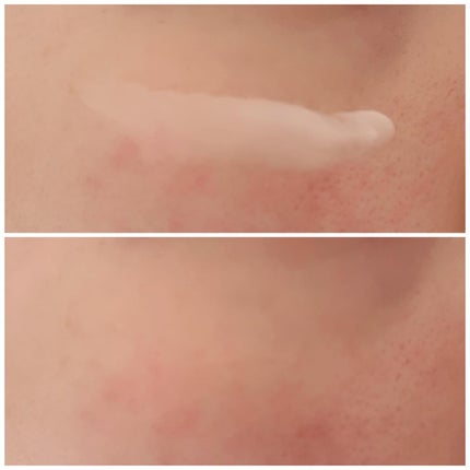 プロバイオダーム リフティング クリーム/BIOHEAL BOH/フェイスクリームを使ったクチコミ(3枚目)