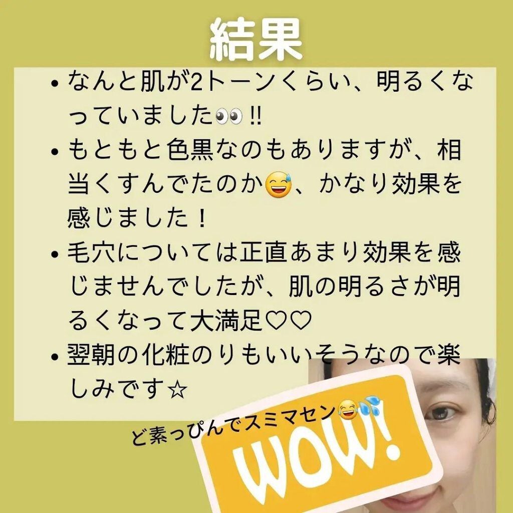 もこもこビタミンC泡マスク/リッツ/シートマスク・パックを使ったクチコミ(7枚目)