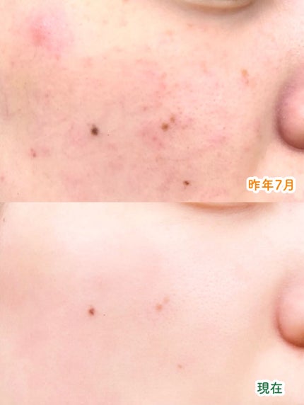 リンクル乳液 N/なめらか本舗/乳液を使ったクチコミ(2枚目)