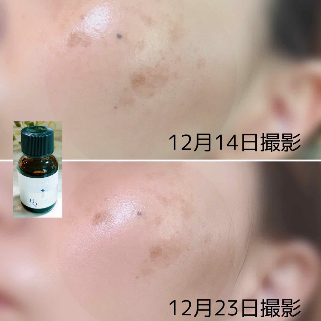 ホワイトラッシュ HQ美容液/White Rush/美容液を使ったクチコミ（3枚目）