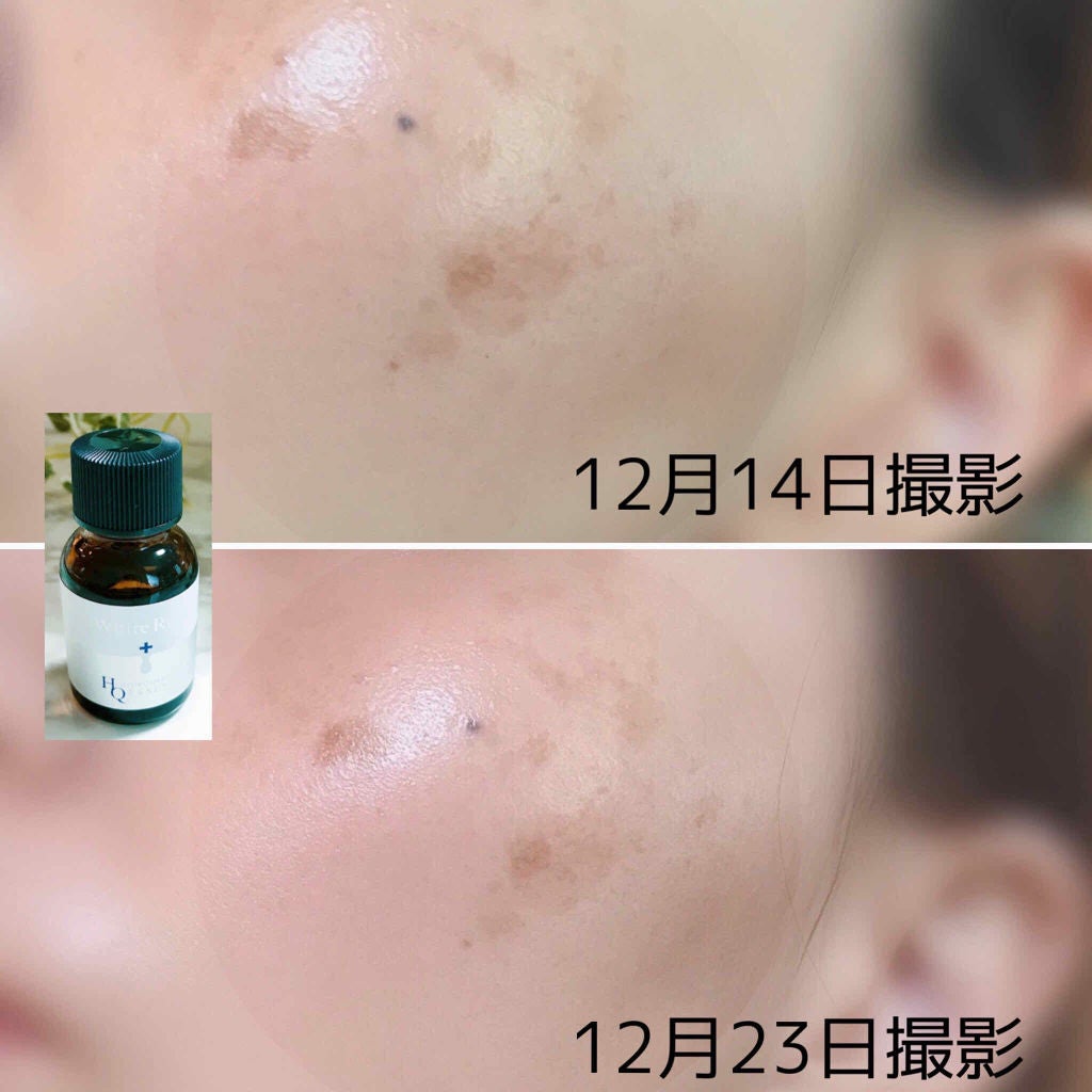 ホワイトラッシュ HQ美容液/White Rush/美容液を使ったクチコミ(3枚目)