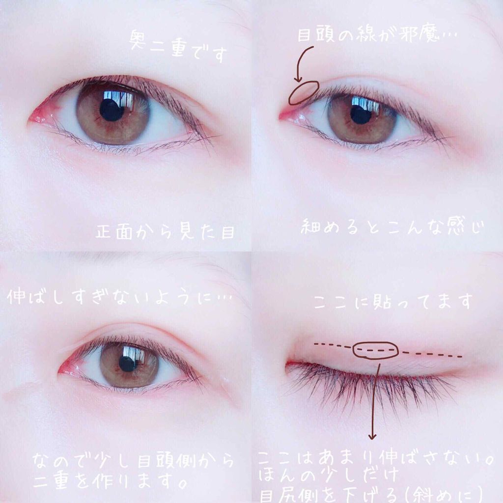 のびーるアイテープ(絆創膏タイプ、レギュラー)/DAISO/二重まぶた用アイテムを使ったクチコミ(2枚目)