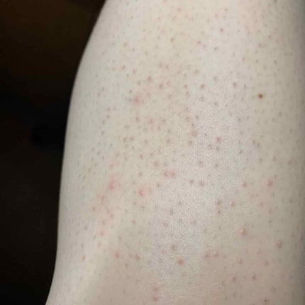 脱毛クリーム MOOMO/自然化粧品研究所/除毛クリームを使ったクチコミ(2枚目)