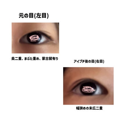 オリシキ アイリッドスキンフィルム /D-UP/二重まぶた用アイテムを使ったクチコミ(4枚目)