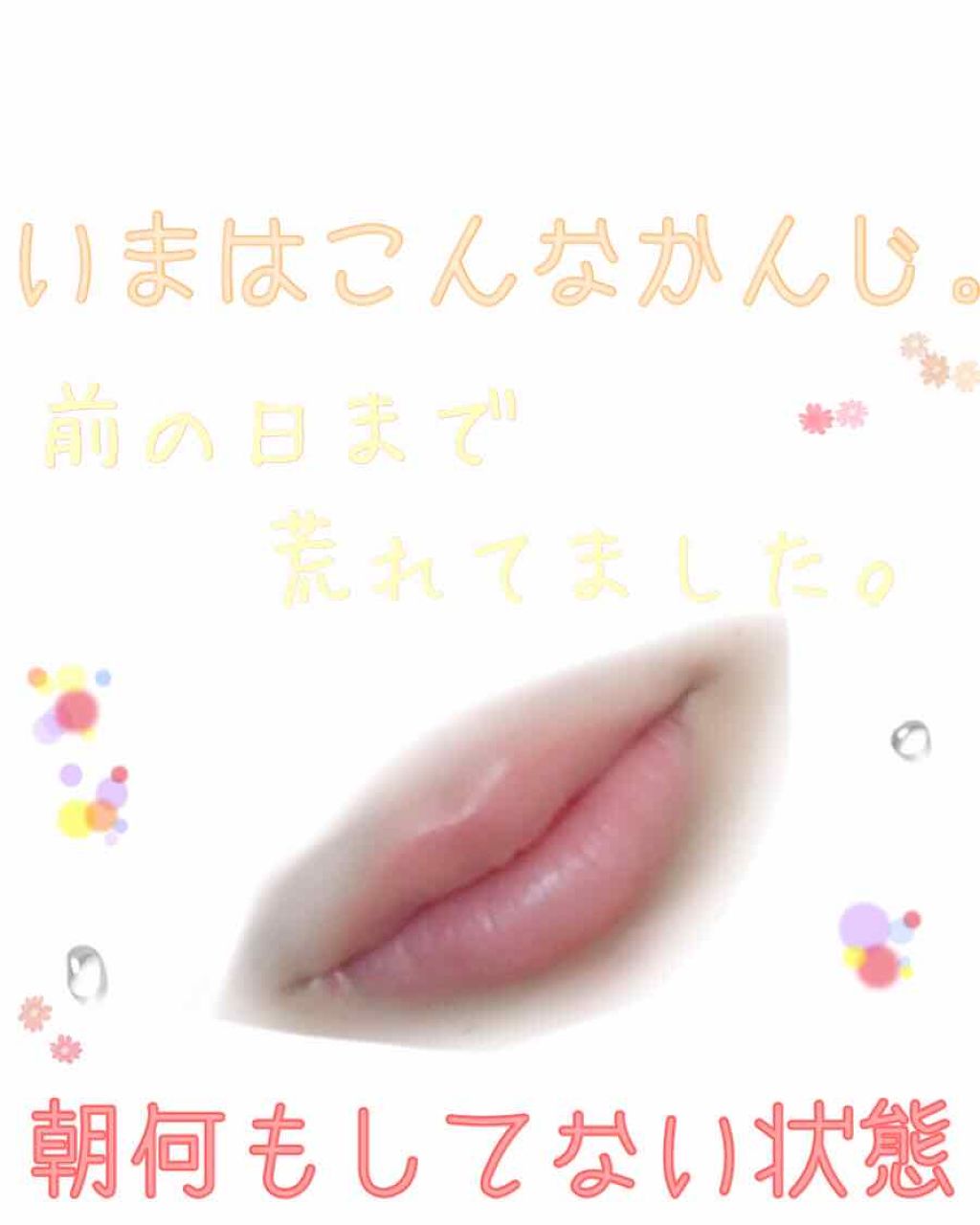 DHC 薬用リップクリーム/DHC/リップクリームを使ったクチコミ（3枚目）