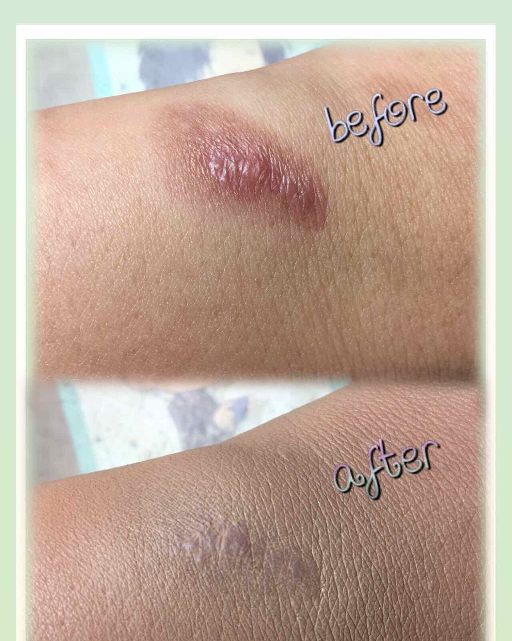 ジョンソン ベビーオイル 無香料/ジョンソンベビー/ボディオイルを使ったクチコミ（2枚目）