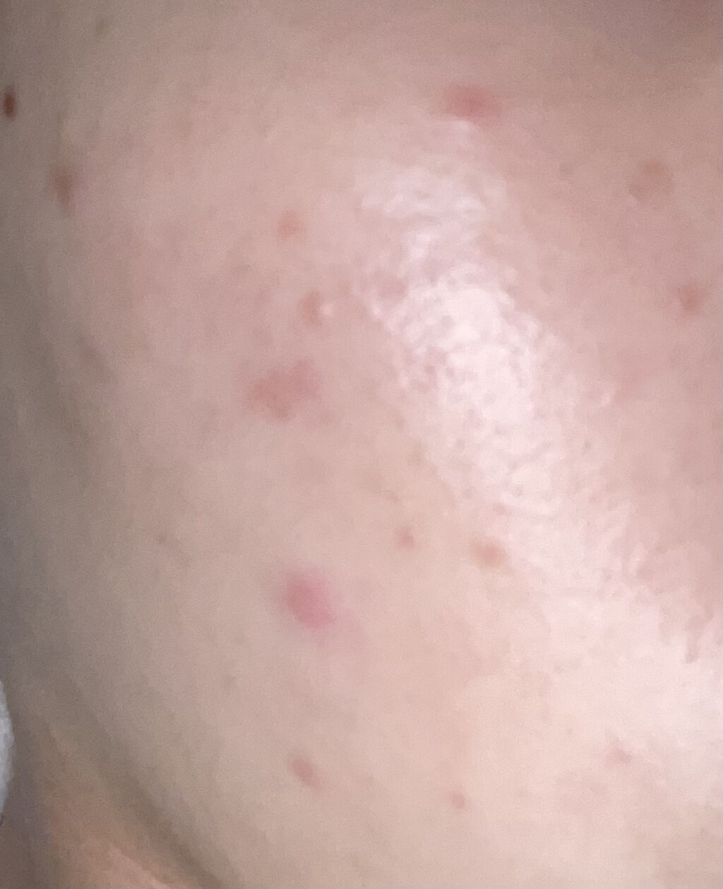 潤浸保湿 化粧水 III とてもしっとり/キュレル/化粧水を使ったクチコミ（2枚目）