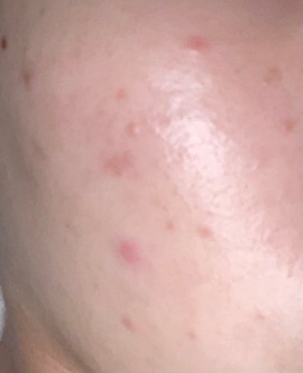 潤浸保湿 化粧水 III とてもしっとり/キュレル/化粧水を使ったクチコミ(2枚目)