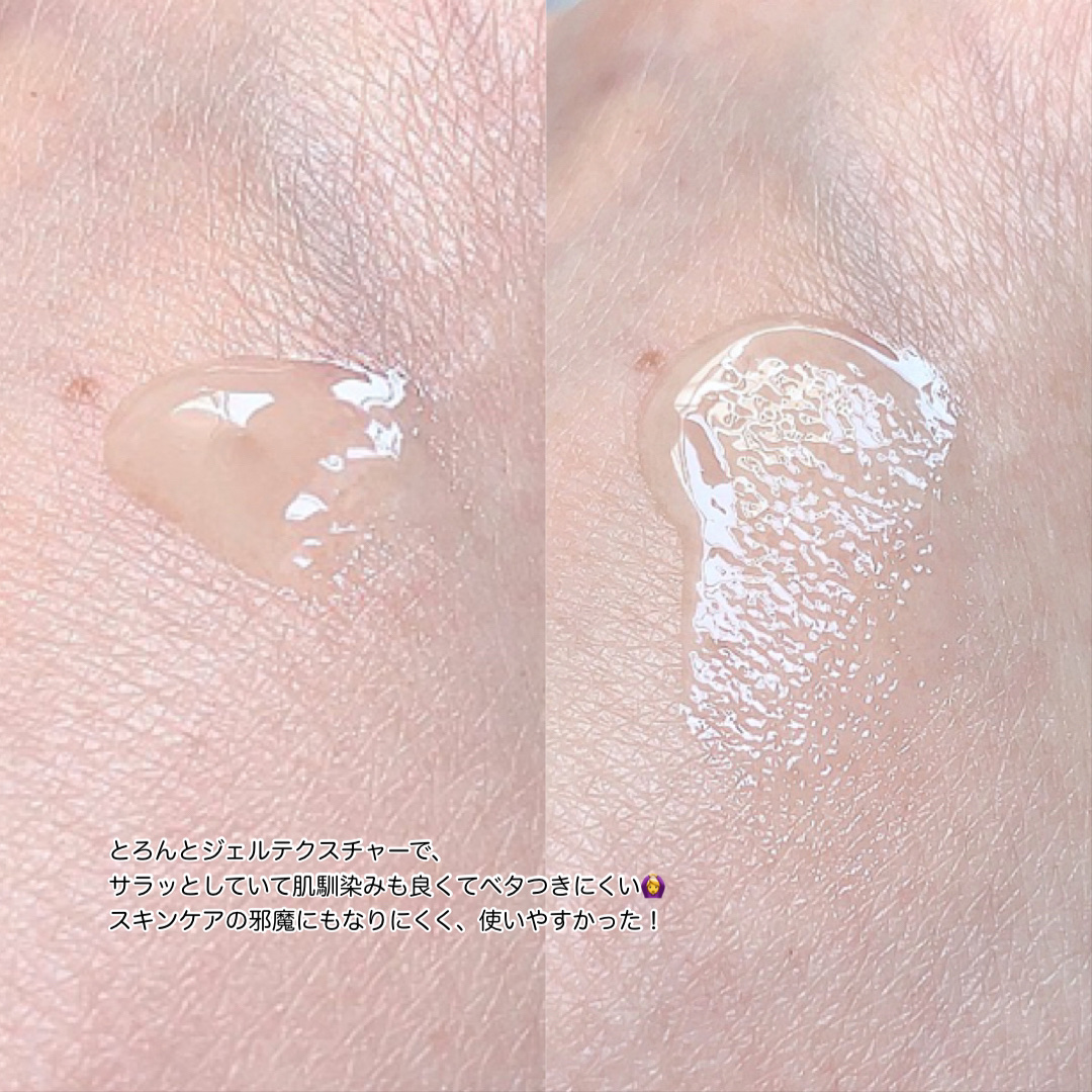 ニキビあとケアジェル/アットノン/その他スキンケアを使ったクチコミ（3枚目）