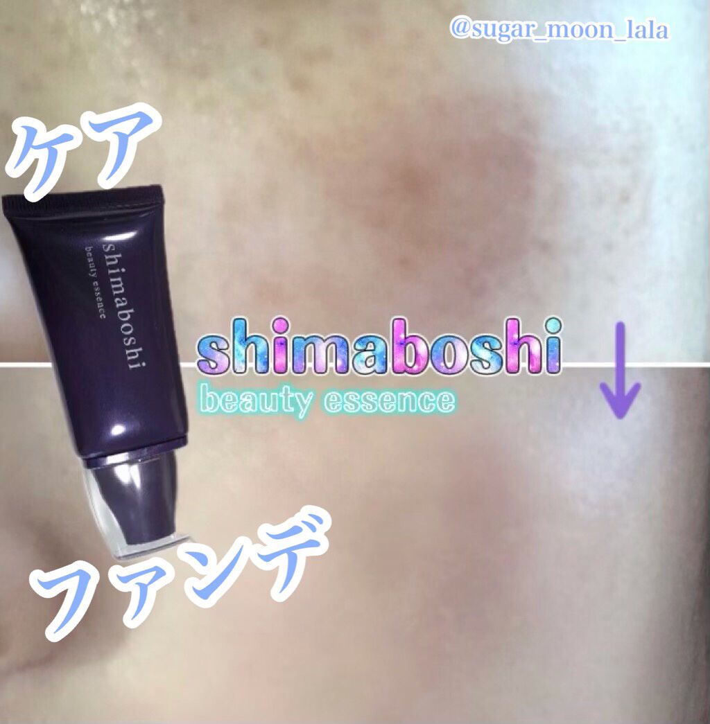 Wエッセンス/shimaboshi/美容液を使ったクチコミ（1枚目）