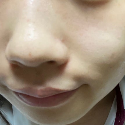 SK-II フェイシャル トリートメント クリア ローションのクチコミ「とにかく鼻と頬と目の下全体のそばかすが気になっているものです笑笑
たまたま𝐈𝐧𝐬𝐭𝐚𝐠𝐫𝐚𝐦を.....」(3枚目)