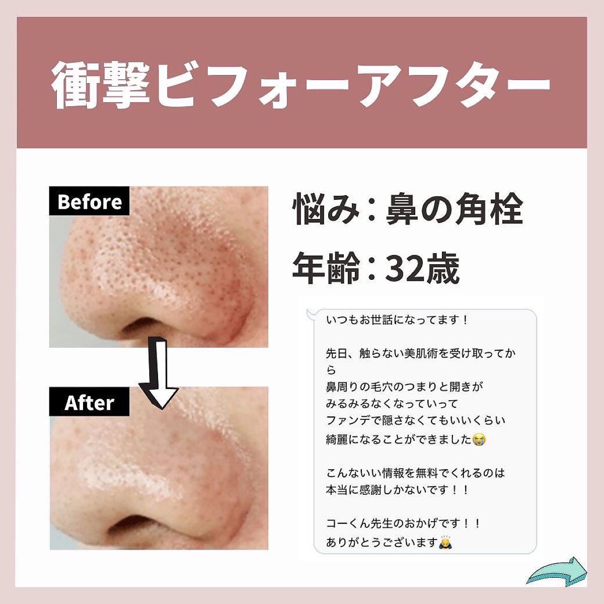 を使ったクチコミ（2枚目）