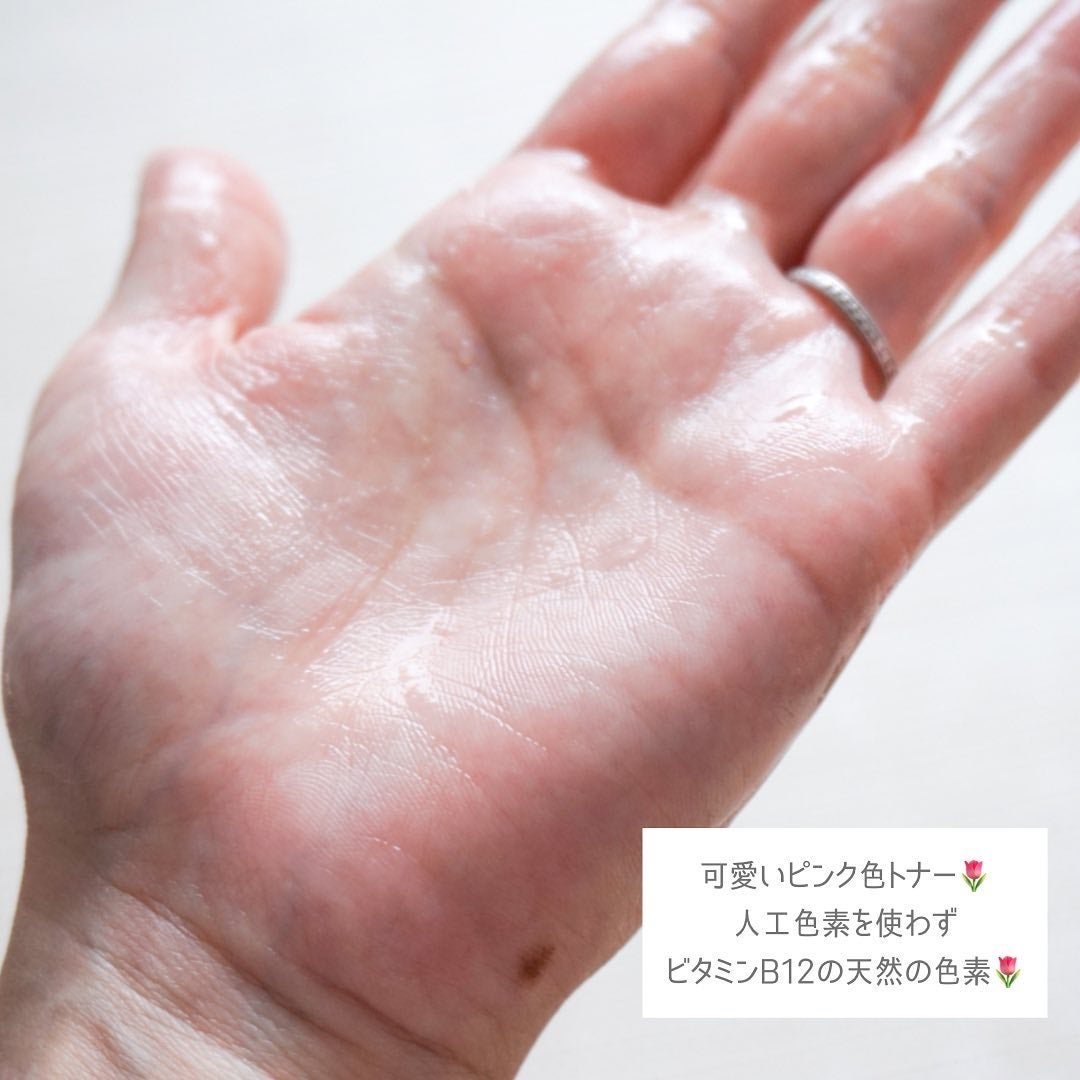 ピンクティーツリートナー/APLIN/化粧水を使ったクチコミ(2枚目)