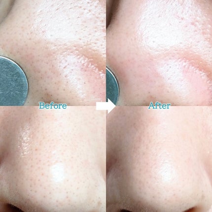 ナチュラルマイルドクリアノーズパック/ilso/シートマスク・パックを使ったクチコミ(4枚目)