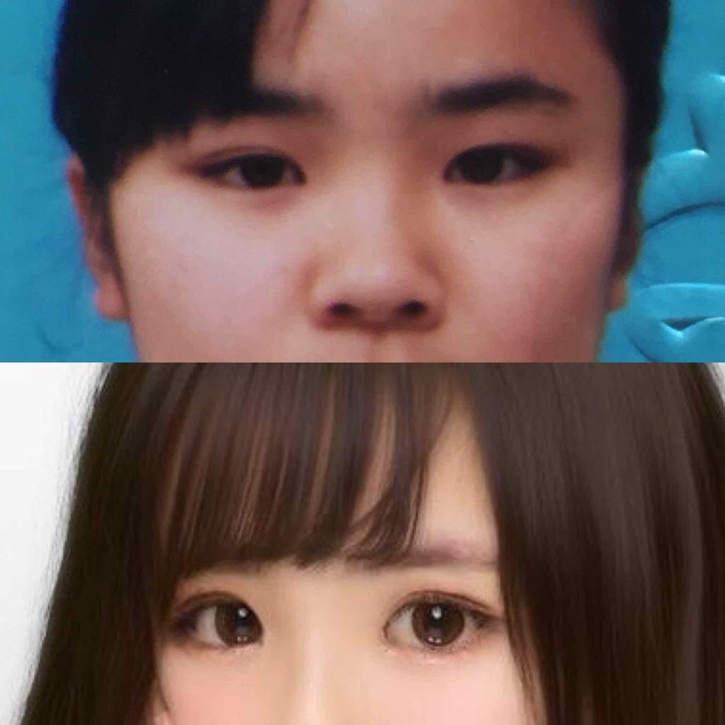 ふたえ用 両面アイテープ スリム/DAISO/二重まぶた用アイテムを使ったクチコミ（3枚目）