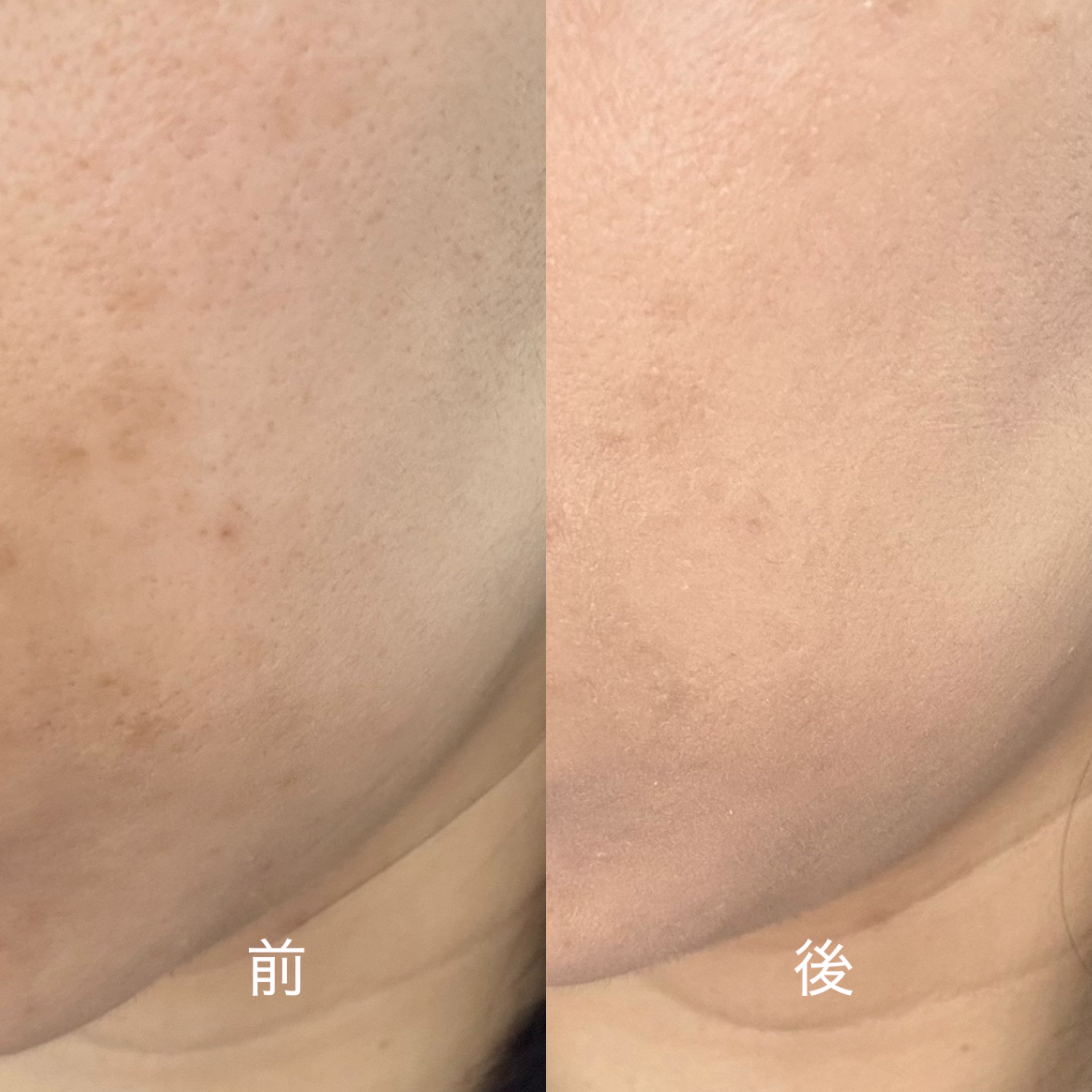 アイレノールすっぴんクリーム/IRENOL/クリームコンシーラーを使ったクチコミ（3枚目）