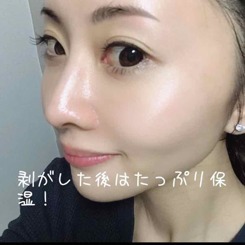 リアルカレンデュラピールオフパック/APRILSKIN/ピーリングを使ったクチコミ(4枚目)