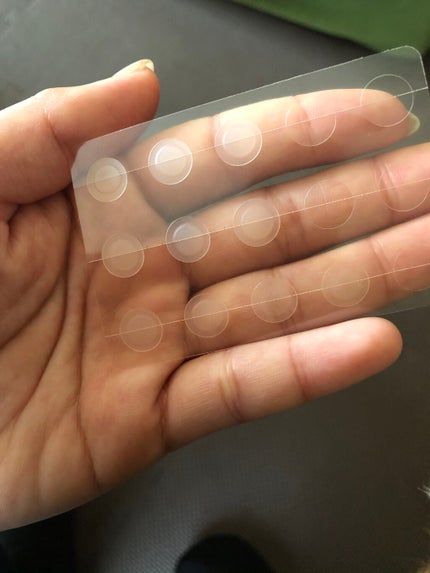 ゼロスポットパッチ/Today’s Cosme/にきびパッチを使ったクチコミ(3枚目)