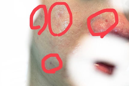 を使ったクチコミ(2枚目)