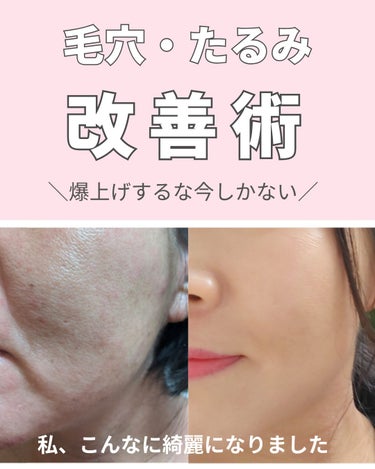 美肌カウンセラー💆綺麗のお助け相談所 on LIPS 「肌を綺麗にする専門家💆美肌カウンセラー洗顔で可愛くなる時代＼肌..」（1枚目）