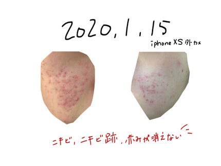 を使ったクチコミ(2枚目)