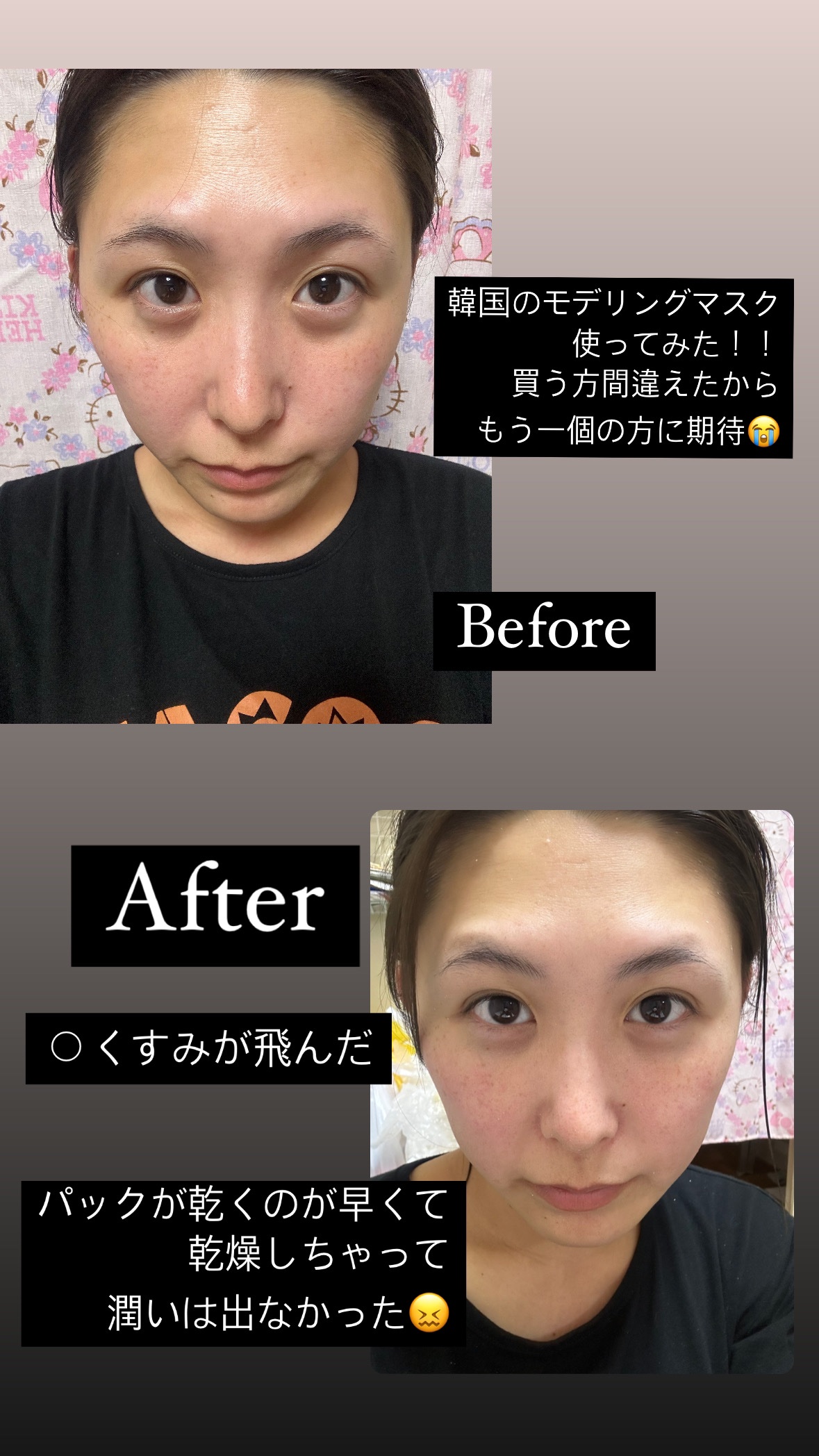 リードルショットEX  ビタミンモデリングパック/VT/シートマスク・パックを使ったクチコミ（2枚目）