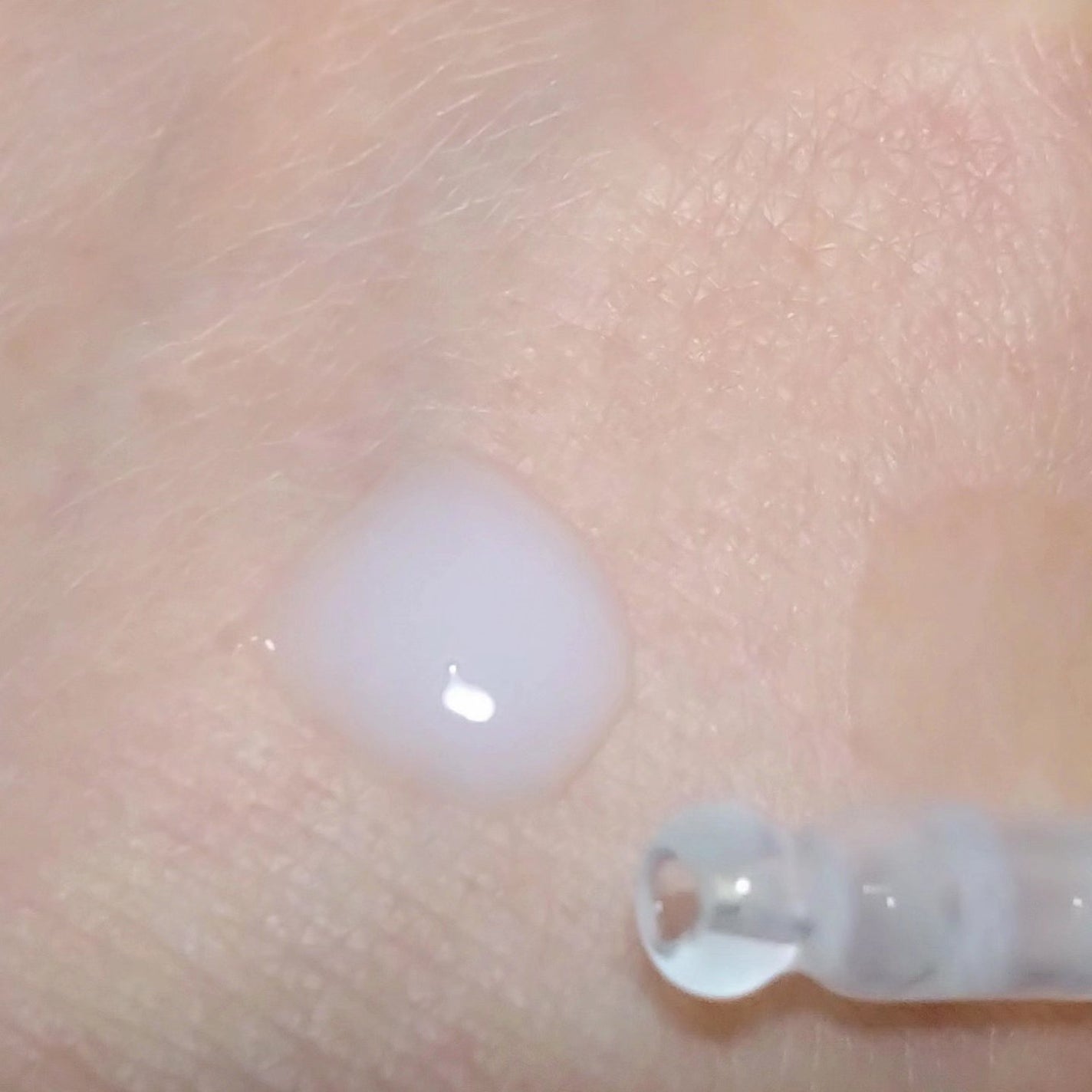 HSCセラム ヒト肝細胞ベースケア美容液/ヴィオテラス/美容液を使ったクチコミ(5枚目)