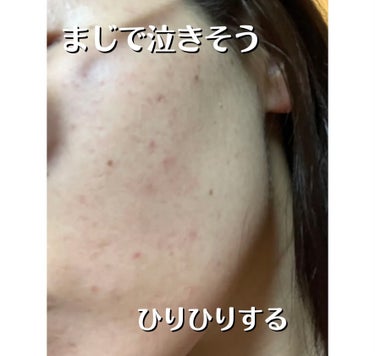 薬用しみ対策 美白化粧水 しっとりタイプ/メラノCC/化粧水を使ったクチコミ（2枚目）