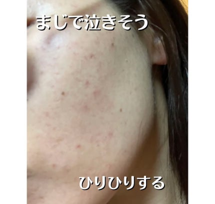 薬用しみ対策 美白化粧水 しっとりタイプ/メラノCC/化粧水を使ったクチコミ(2枚目)