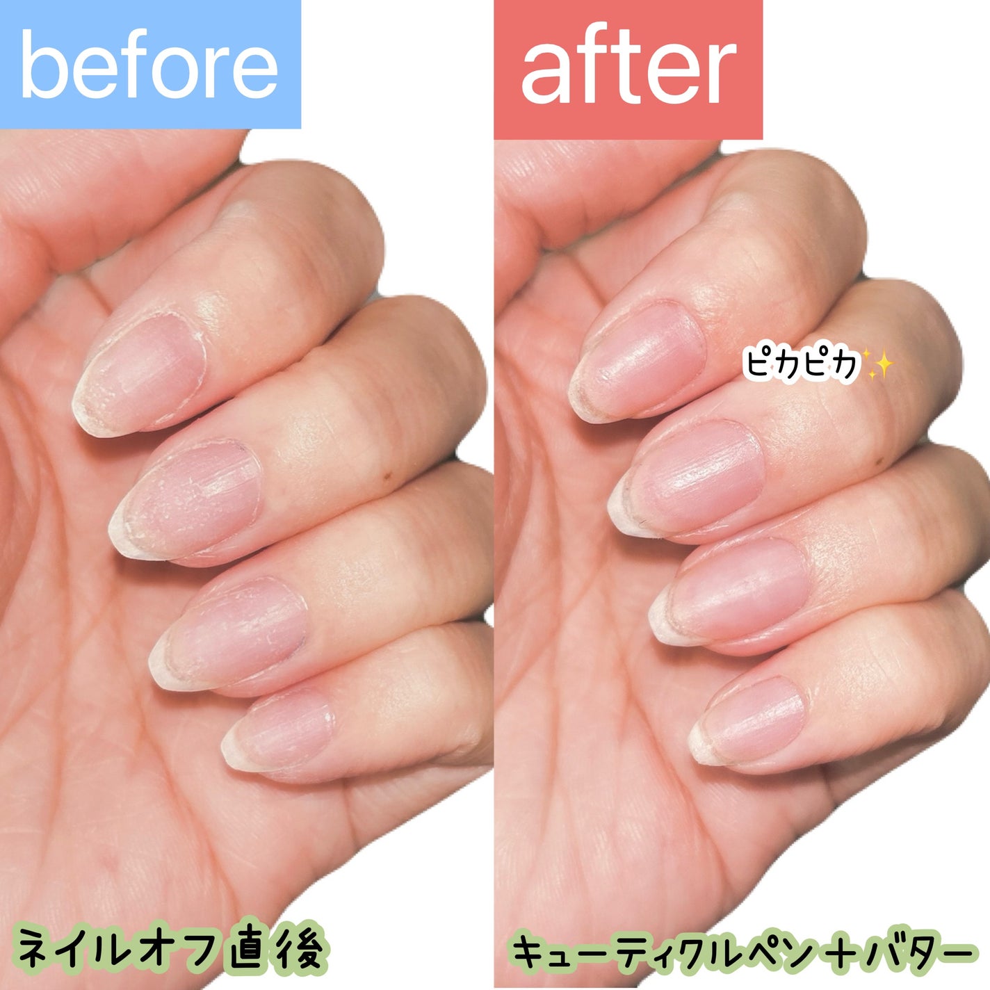 キューティクルペン/enieni /ネイルオイル・トリートメントを使ったクチコミ(5枚目)