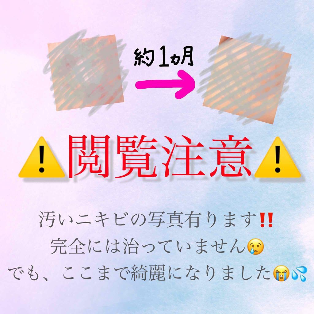 ハトムギ化粧水(ナチュリエ スキンコンディショナー R )/ナチュリエ/化粧水を使ったクチコミ(1枚目)