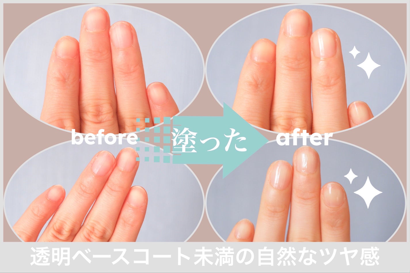 エテュセ クイックケアコート/ettusais/ネイルオイル・トリートメントを使ったクチコミ(1枚目)